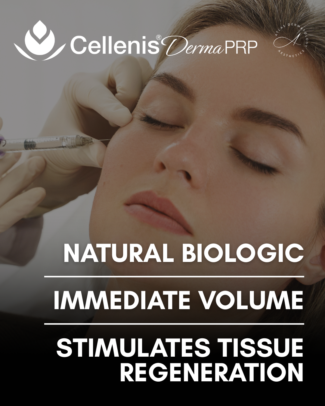 PRP filler by Cellenis  22 ml